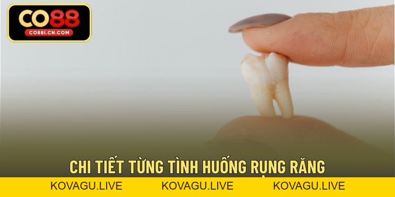 Mơ Thấy Rụng Răng Đánh Số Gì – Giải Mã Giấc Mơ Phổ Biến - kovagu